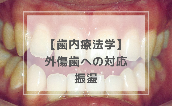 歯科医師国家試験 口腔内科(送料430円込) 歯内療法学：振盪（計2問）【歯科医師国家試験】（2025年10月17日更新