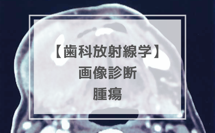 歯科放射線学：画像診断：腫瘍など（計17問）【歯科医師国家試験