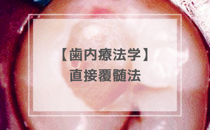 歯内治療学 12-3-1.png