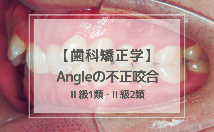 歯科矯正学：Angleの不正咬合（計11問）【歯科医師国家試験】（2025年