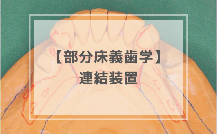 部分床義歯学：連結装置（計13問）【歯科医師国家試験】（2020年8月9日