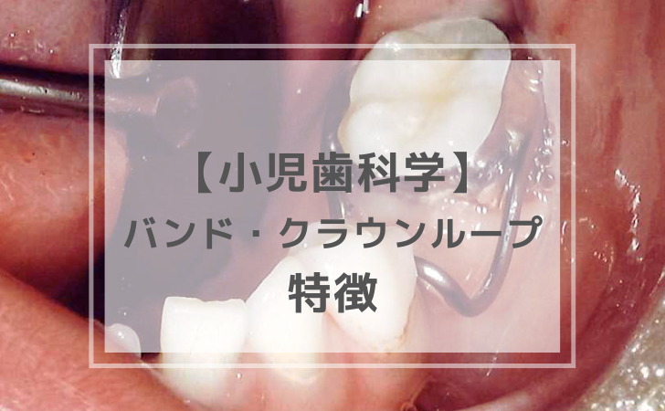 小児歯科学： クラウン・バンドループの特徴（計5問）【歯科医師国家