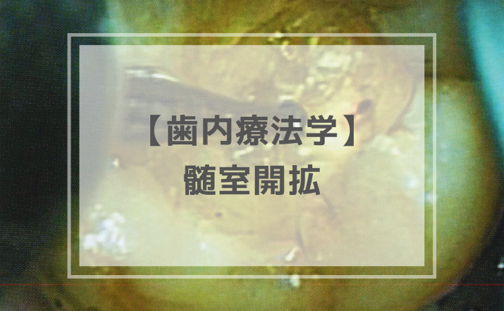 歯内療法学：髄室開拡（計9問）【歯科医師国家試験】（2025年10月12日