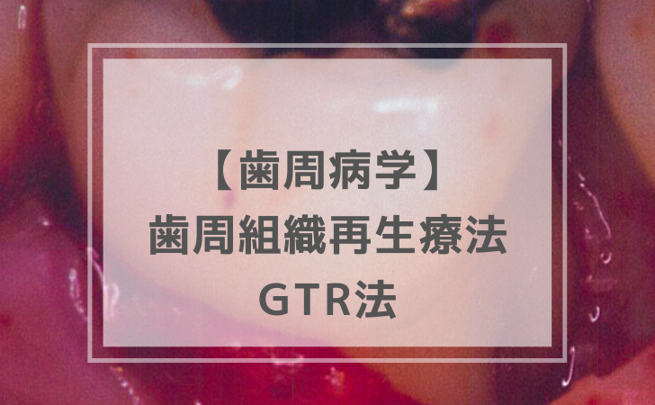 【前作購入者専用】120回歯科医師国家試験合否を決める極秘資料完全版【残り数冊】 歯周病学：GTR法（計18問）【歯科医師国家試験】（2025年10月23日更新