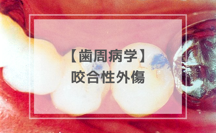 歯周病学：咬合性外傷（計13問）【歯科医師国家試験】（2025年10月29日