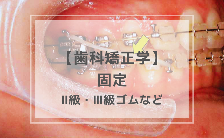 矯正歯科学：固定（部位による分類）（計9問）【歯科医師国家試験