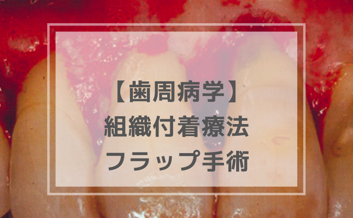 歯周病学：フラップ手術（計26問）【歯科医師国家試験】（2025年10月23