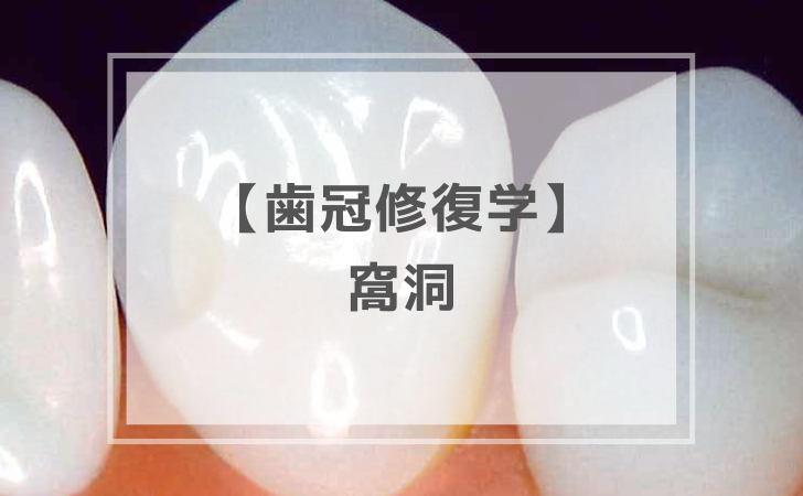 【過去問】歯冠修復学-2-3.png