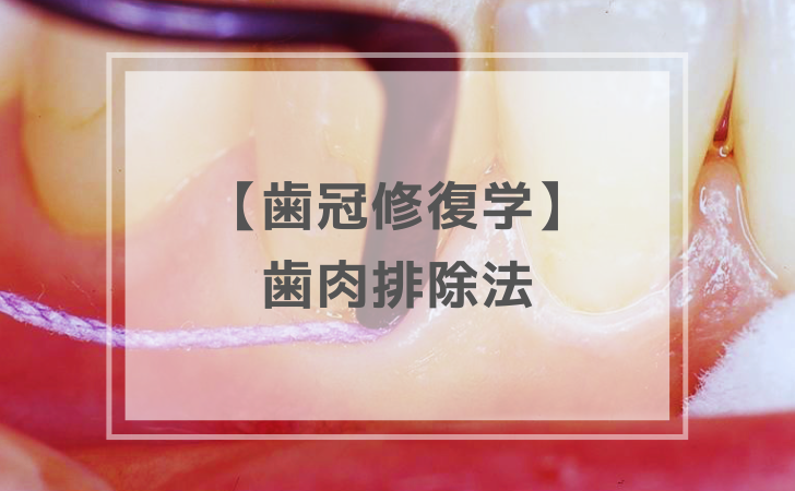 歯冠修復学：歯肉排除法（計4問）【歯科医師国家試験】（2025年10月13