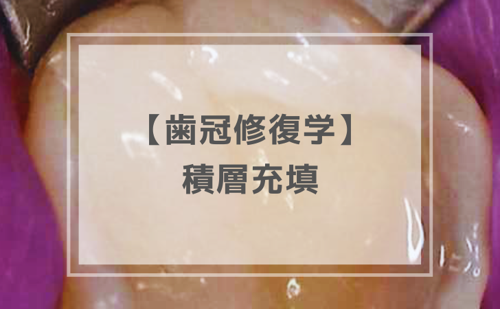 【過去問】歯冠修復学-5-2.png