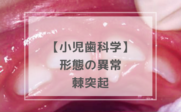 小児歯科学 小児歯科学： 棘突起など（計8問）【歯科医師国家試験】（2025年11月5