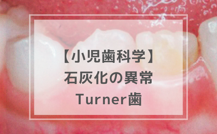 小児歯科学： Turner歯（計10問）【歯科医師国家試験】（2025年11月5日