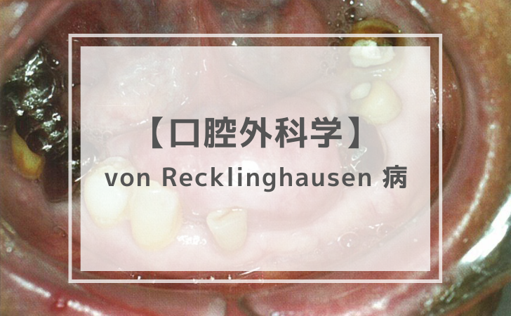 口腔外科学：von Recklinghausen 病（計5問）【歯科医師国家試験