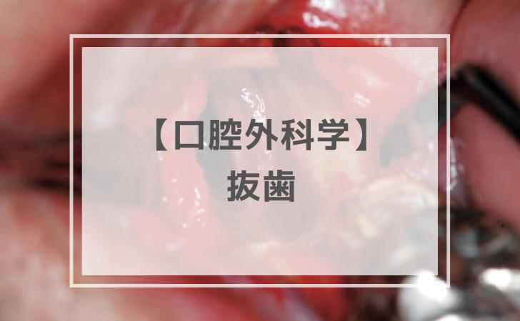 口腔外科学：抜歯（計26問）【歯科医師国家試験】（2026年1月25日更新