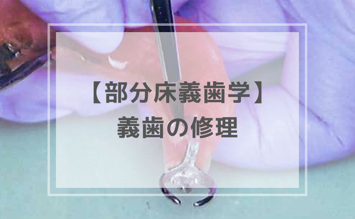 部分床義歯学：術後管理 ~ 義歯の修理~（計6問）【歯科医師国家試験